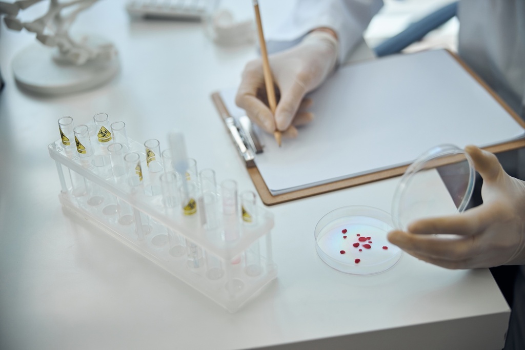 Alcohol Determination - Alcohol (5 mL/ampule; 5 ampules),